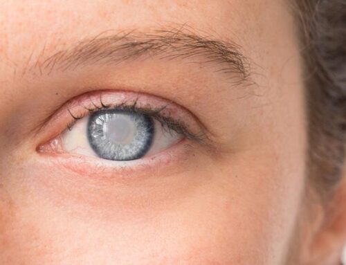 Unexpected Benefits of Cataract Surgery