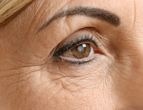 How Long Does Cataract Surgery Last?