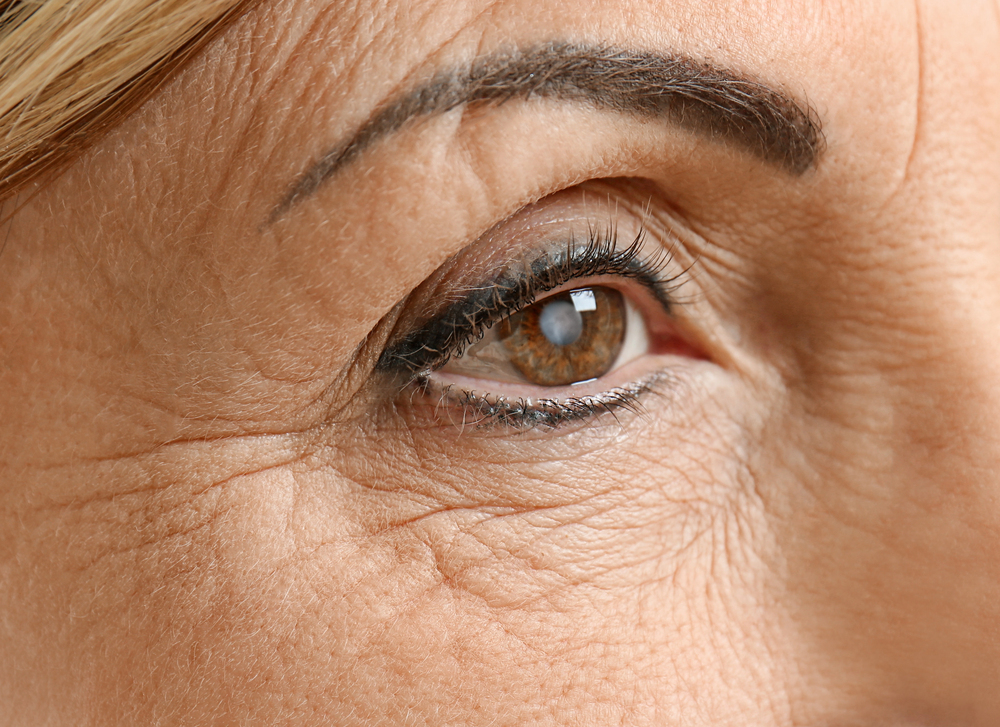 how long does cataract surgery last
